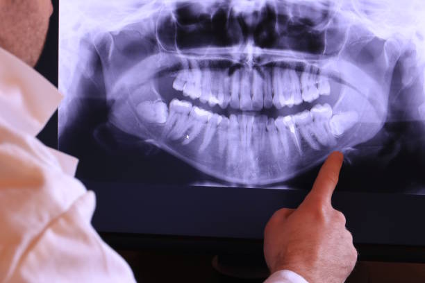 Best Dentist for Tooth Abscess  in Albion, IL