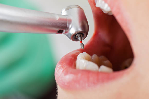 Best Tooth Infection Emergency Dentist  in Albion, IL